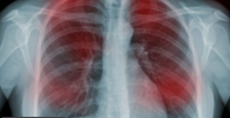 20 Early Signs Your Body is Fighting Cancer