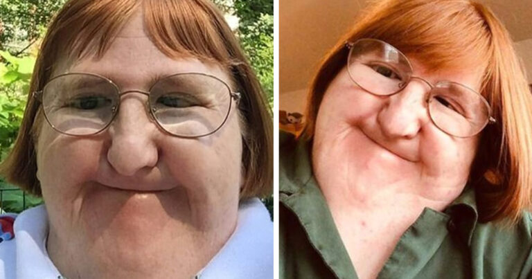 Bullied woman ‘too ugly’ for selfies takes one a day for a year