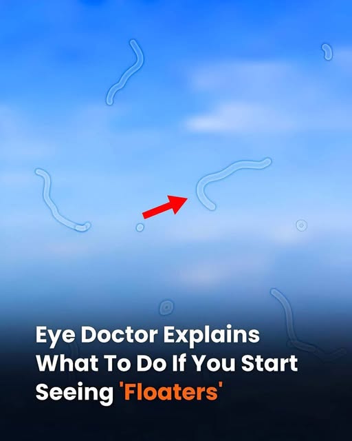 What Are Eye Floaters? Here What To Do If you Start Seeing Them, According to an Eye Doctor