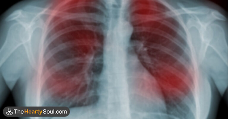 20 Early Signs Your Body is Fighting Cancer