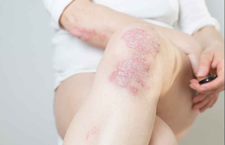 11 Reasons Why You Have Red Dots On Your Skin