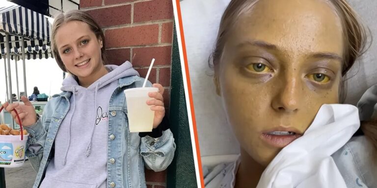 ‘I Didn’t Think I Was Dying’: Girl Thought She Had a Stomach Bug – But Doctors Discovered a Deadly & Incurable Disease