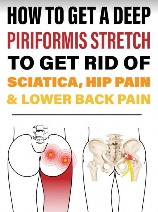 Effective Piriformis Stretch to Ease Lower Back, Hip, and Sciatic Nerve Pain
