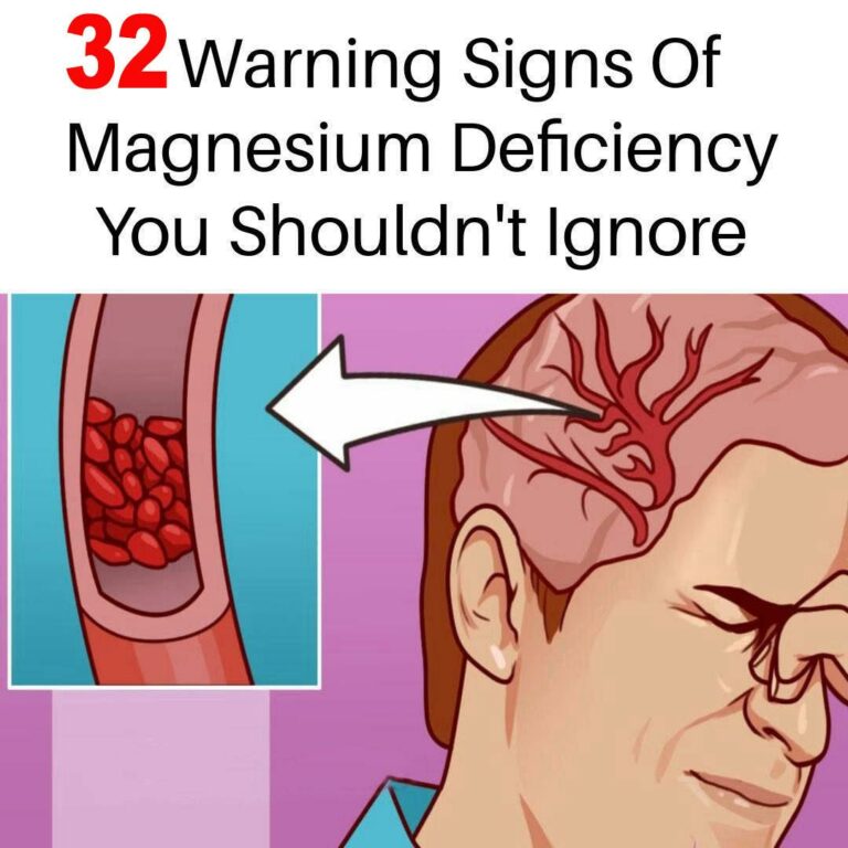 32 Signs You Have a Magnesium Deficiency & 23 Foods You Need to Start Eating Immediately