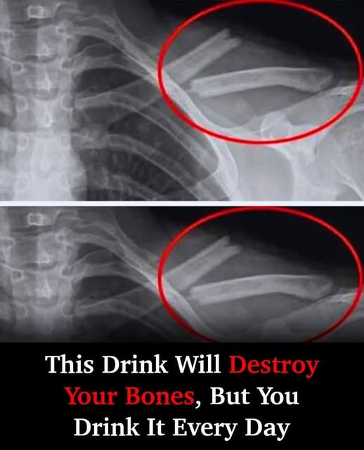 8 Detrimental Effects Soda Can Have On Your Body