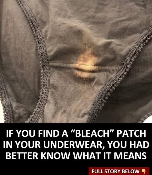 Reason behind the “bleach” patch on your underwear