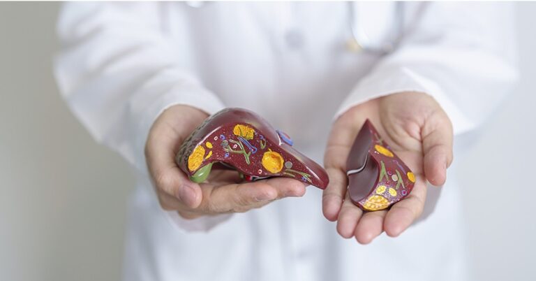 The Link Between Vitamin D Deficiency and Fatty Liver